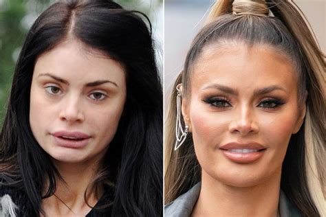 chloe sims surgery